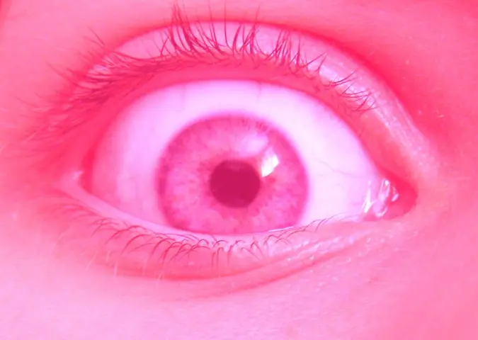 Nejrůžovější foto - Oko metamorfomága